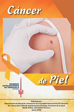 Cáncer de Piel