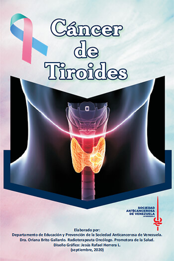 Cáncer de Tiroides