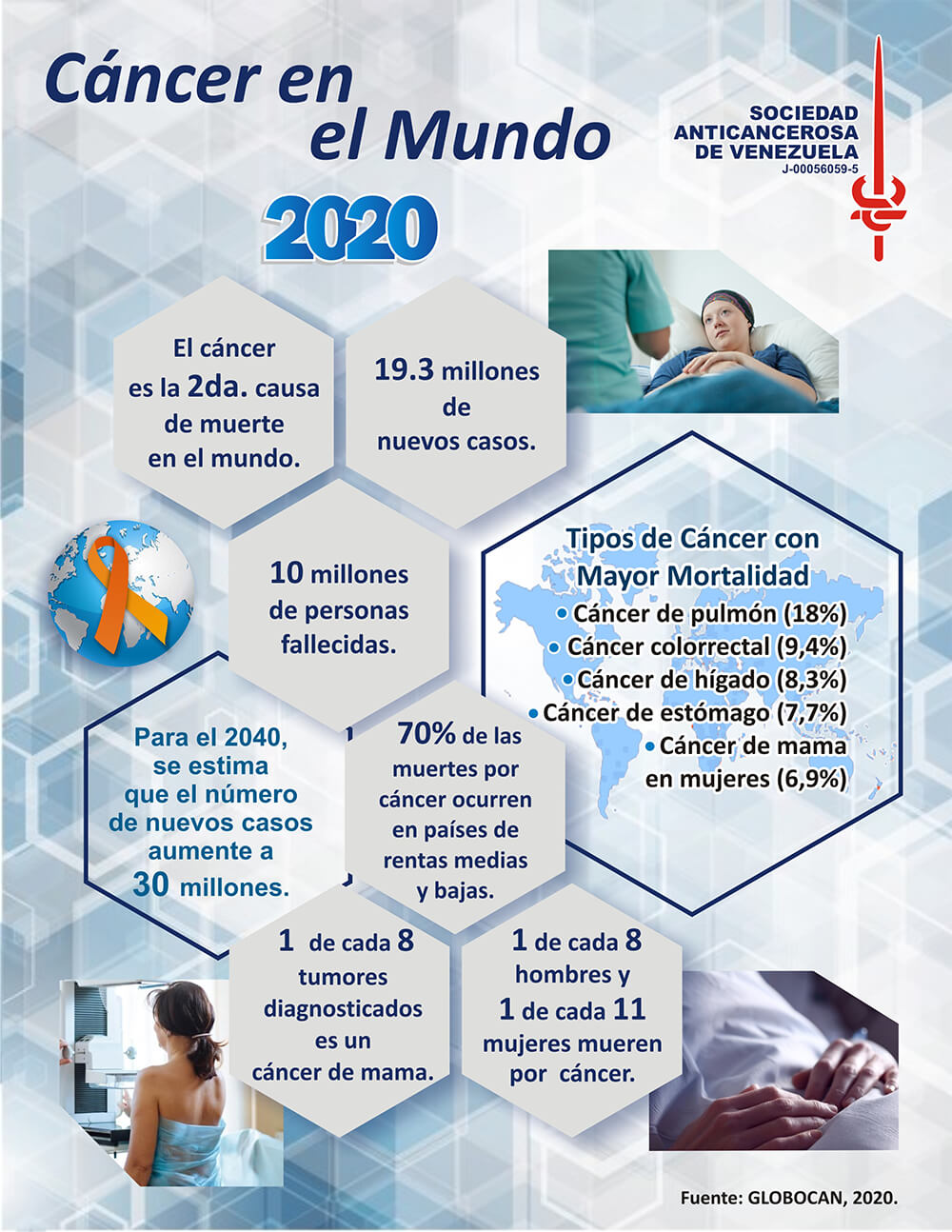 Cáncer en el mundo 2020