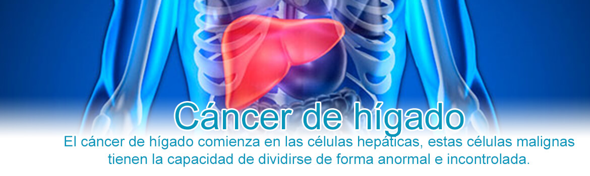 Cáncer de Hígado