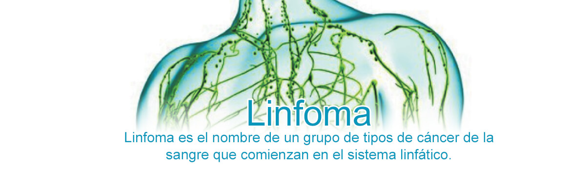 Linfoma