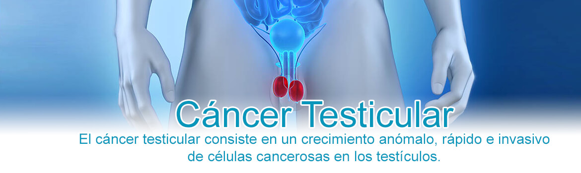 Cáncer Testicular