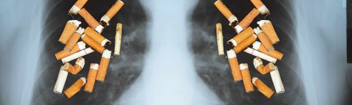 ¿Sabes cómo prevenir el cáncer de pulmón?